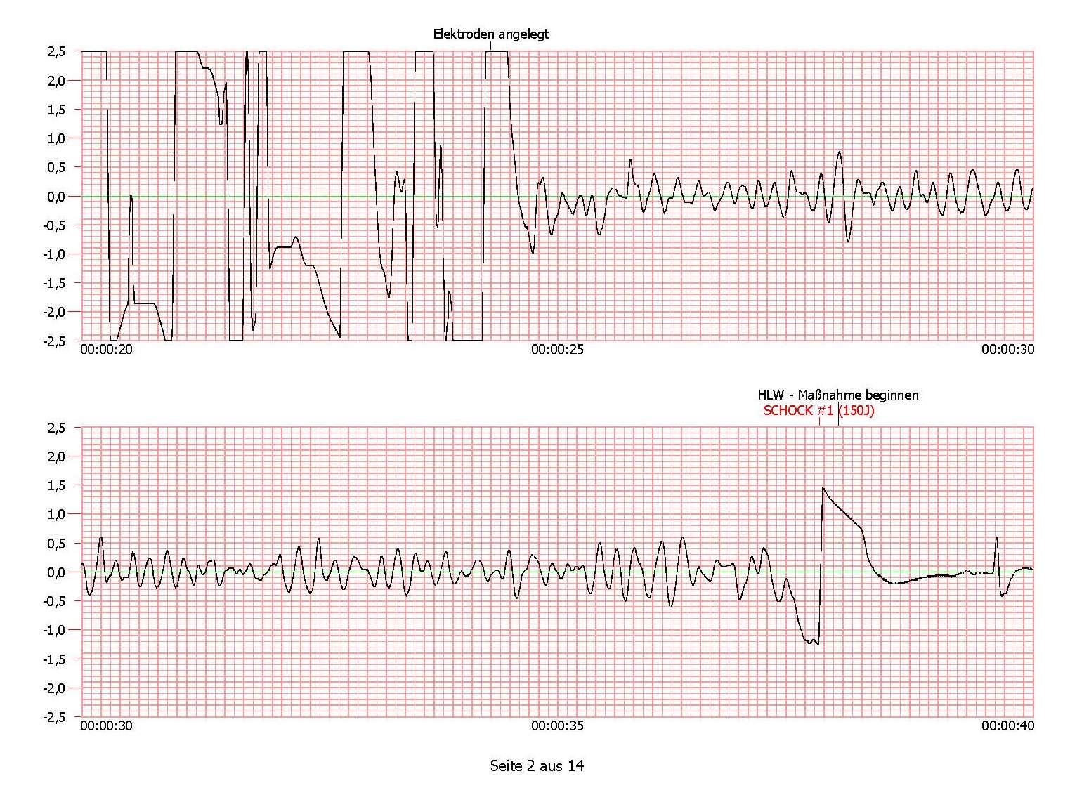 HeartSine Defibrillator Aufbereitung nach Einsatz, inkl. STK, Leihgerät, Forward Hearts Programm